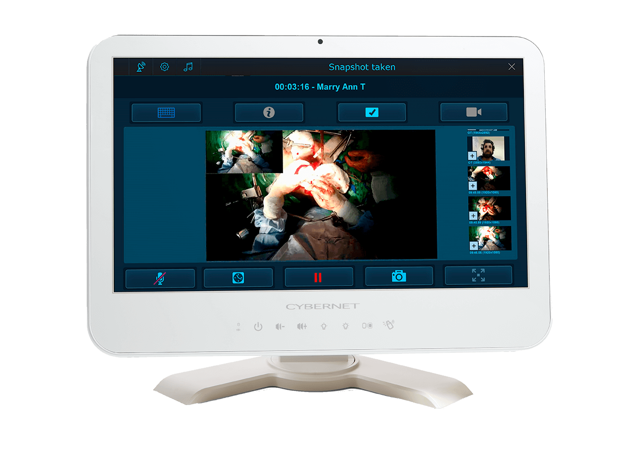 CB SVIS-CAST screen