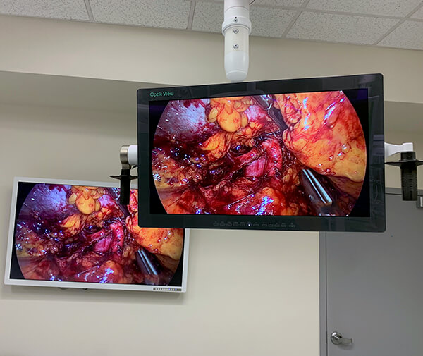 Optik 2 Screens